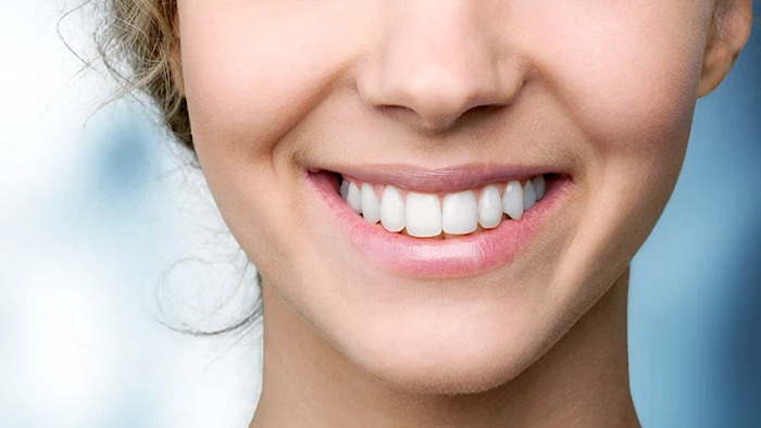 Smile Design