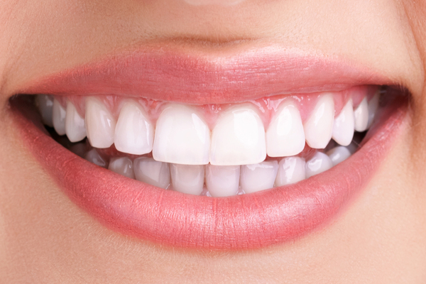 All-on-4 / All-on-6 Implants