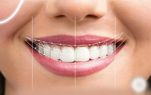 Teeth Whitening