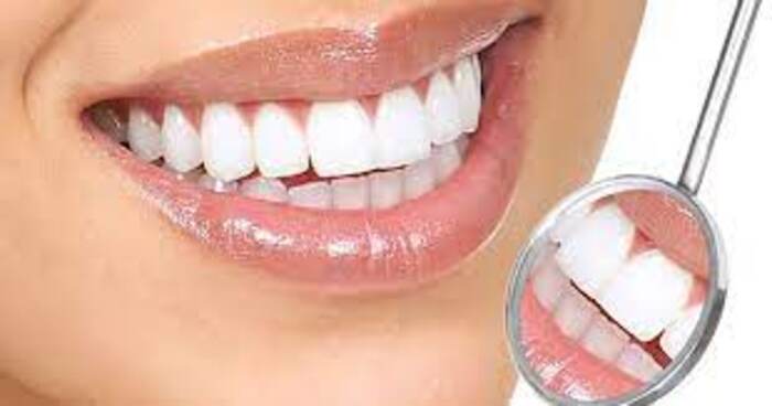 Full Mouth Rehabilitation